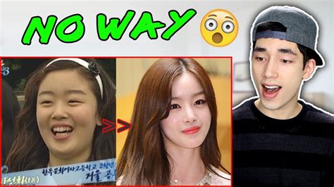Kpop Stars Plastic Surgery Before And After Photos REACTION YouTube