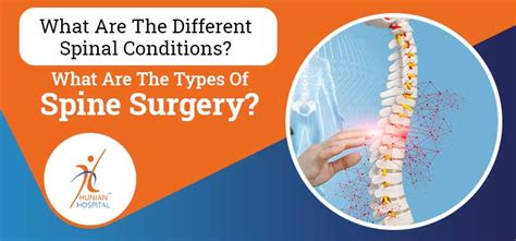 What Are The Different Spinal Conditions What Are The Types Of Spine
