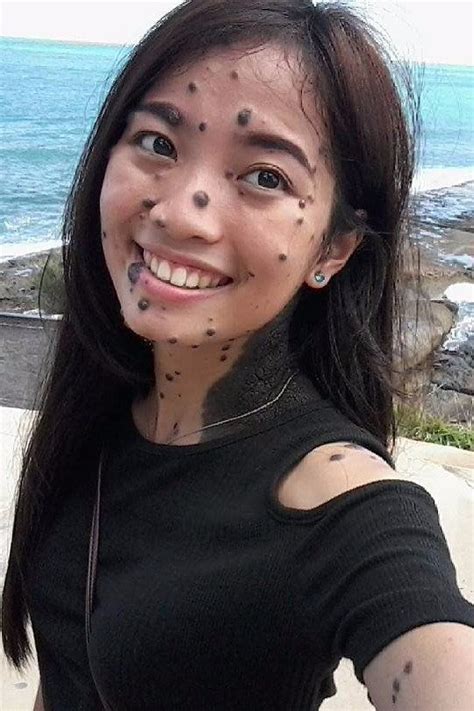 How 1 Woman Learned To Embrace Her Body Covered In Moles Pretty People Beatiful People