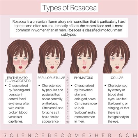 What Are The Different Types Of Rosacea And How Can They Be Treated