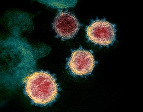 Virus Test Results In Minutes Scientists Question Accuracy