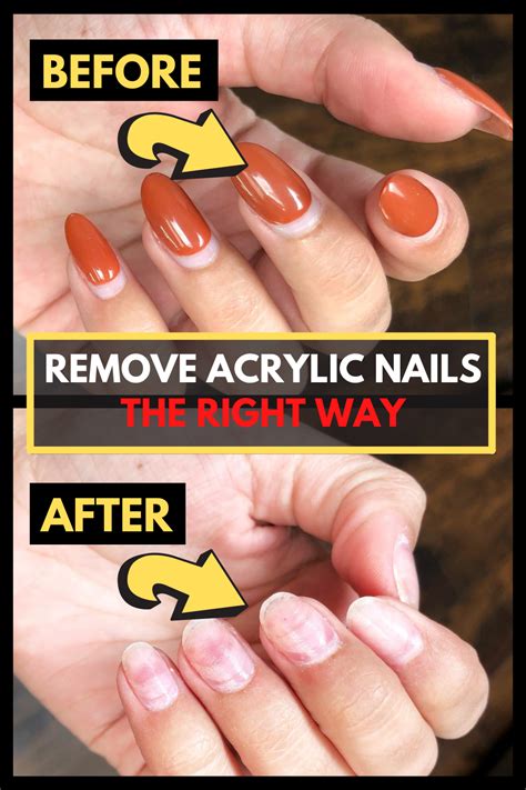 How To Remove Acrylic Nails The Right Way At Home Remove Acrylic