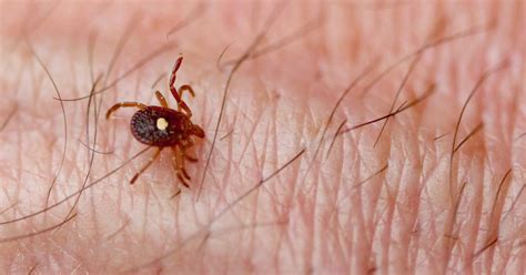 Tick Bites Are Causing Deathly Allergic Reactions To Red Meat