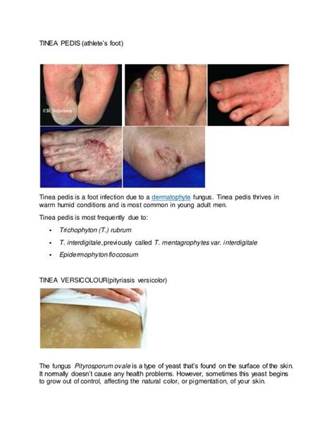 Skin Fungal Infections