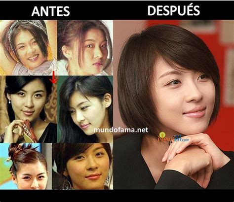 Coreanos Antes Y DespuÉs De La CirugÍas ~ Korean Wave