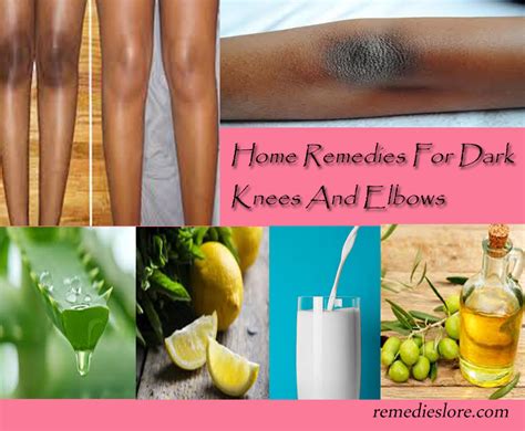 How To Get Rid Of Dark Knees And Elbows Remedies Lore