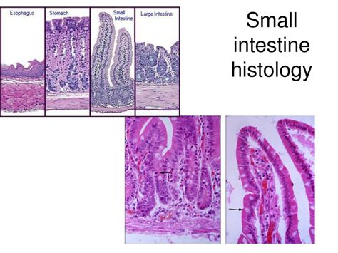 Ppt Stomach Histology Powerpoint Presentation Free Download Id3095088