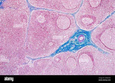 Lymph Node Light Micrograph Of A Section Through A Lymph Node A