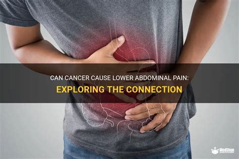Can Cancer Cause Lower Abdominal Pain Exploring The Connection MedShun