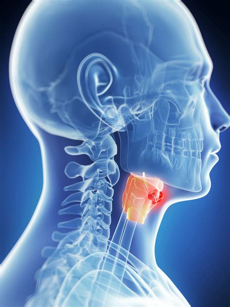 Laryngeal Cancer Treatment Prognosis And More