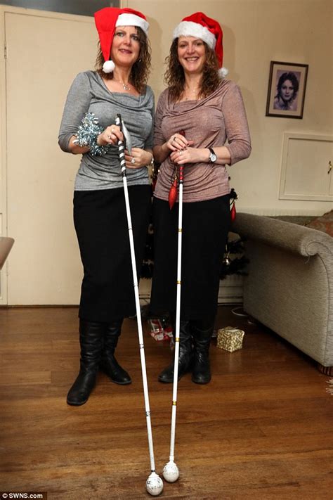 Sisters With Eye Disease Macular Dystrophy Fear This Is The Last
