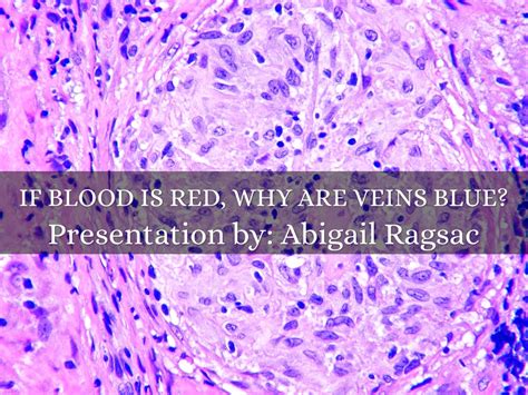 Copy Of If Blood Is Redwhy Are Veins Blue By Abigail