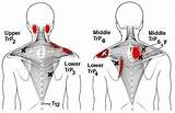 Images of Trapezius Muscle Exercise Pain