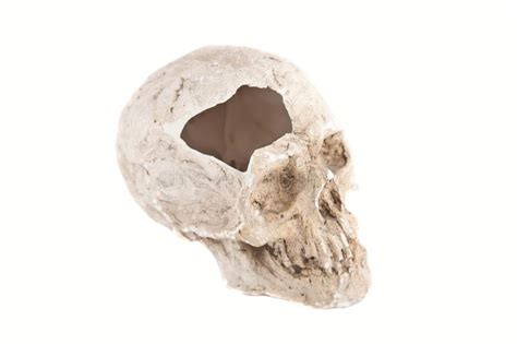 Broken Skull Stock Image Image Of Bone Spine Human 26153687
