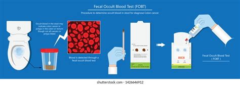 Fecal Occult Blood Test Fobt Lab Stock Vector Royalty Free 1426646912