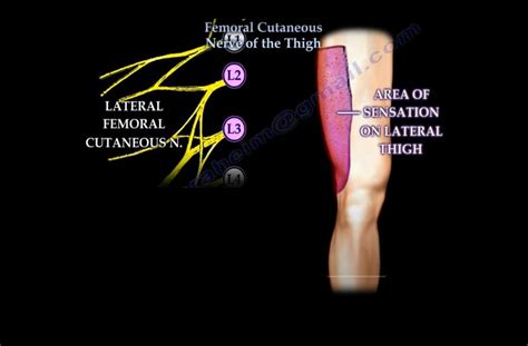 Lateral Femoral Cutaneous Nerve Dermatome Dermatomes Chart And Map