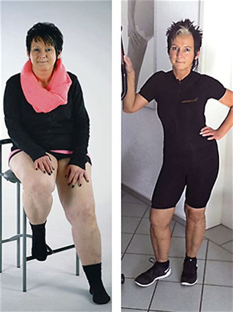 36,654 likes · 19 talking about this. Increased quality of life for women with Lipoedema | HYPOXI