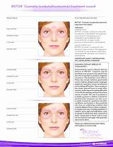 Botox Treatment Record Form Pictures