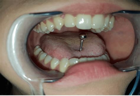 The Aspect Of Crosstongue Pierce Large Barbell Piercing In The Midline