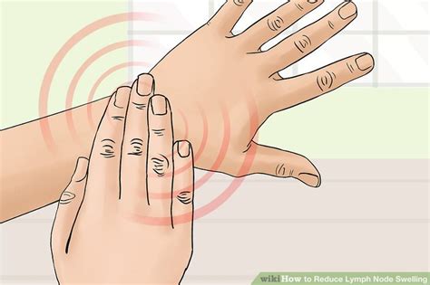 3 Ways To Reduce Lymph Node Swelling Wikihow