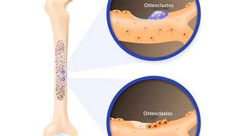 Osteogénesis La Formación De Los Huesos Mejor Con Salud