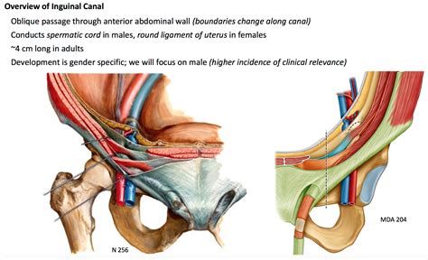 The anatomy of the inguinal canal is important to know because it has clinical relevance. Round Ligament Inguinal Hernia - Carles Pen