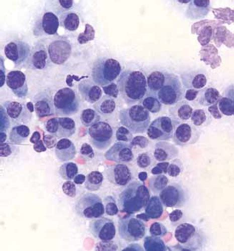Basal Cell Tumor Dog Cytology
