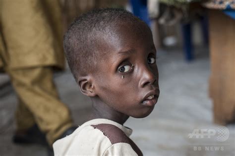 子どもたちに深刻な栄養失調、ボコ・ハラムによる「もう一つの悲劇」 写真10枚 国際ニュース：afpbb News