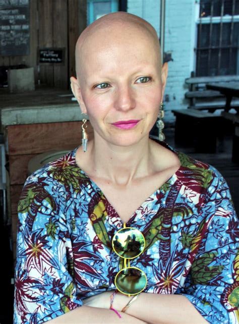 Four Women Bond Over The Beauty In Their Baldness The New York Times