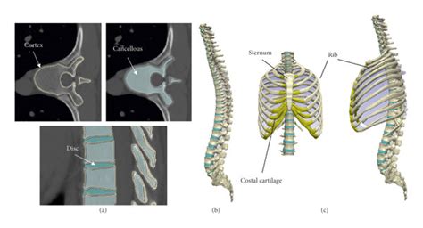 Model Construction A Cancellous And Cortical Bones And The