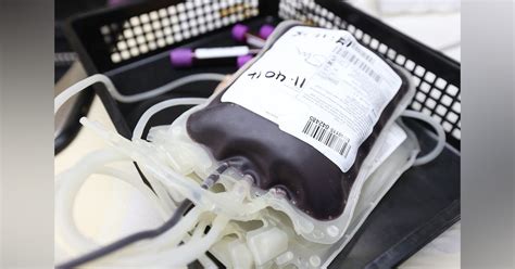 Aabb Session Explores Blood Donation Deferral Policies Medical