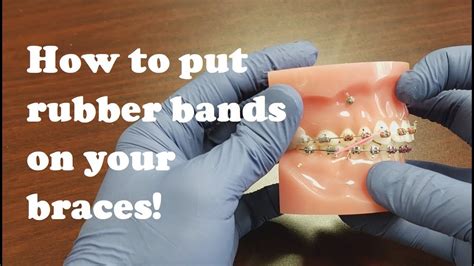 Tutorial How To Put Rubber Bands On Your Braces Youtube
