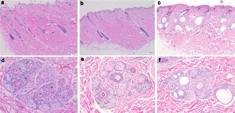 Domestic Shorthair And Lykoi Cat Longitudinal And Transverse Skin