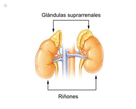 Glándulas suprarrenales qué es síntomas y tratamiento Top Doctors
