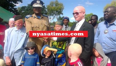 Malawi Police Register Albinos To End Horrific Trade In Body Parts
