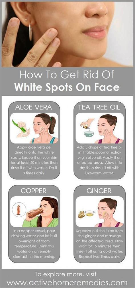 How To Get Rid Of White Spots On Face Getridofbrownspotsonface