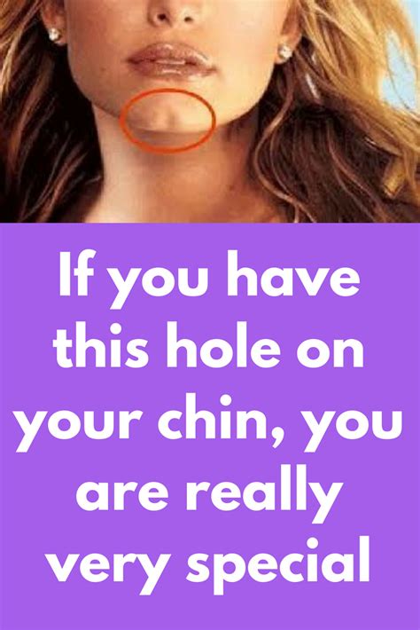 If You Have This Hole On Your Chin You Are Really Very Special