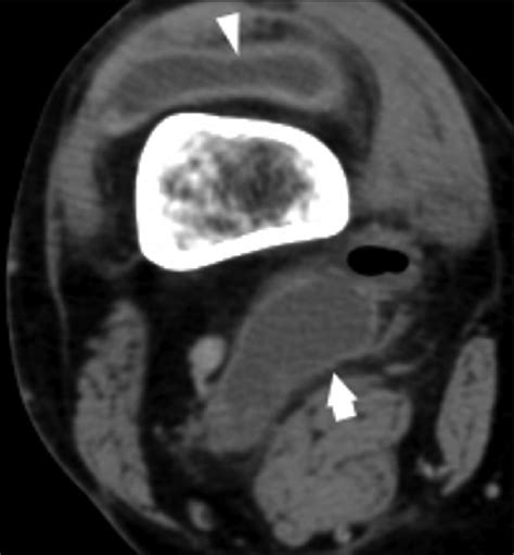 Contrast Enhanced Axial Computed Tomography Ct Scan Of The Right Knee