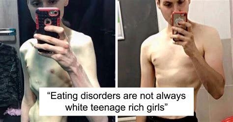 Tumblr Users Explain How Men Can Have Anorexia Too After Someone Begins