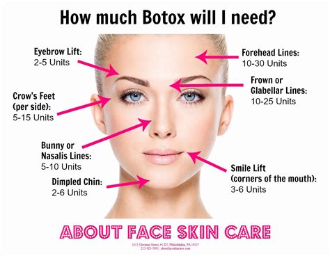 Botox Injection Sites Face Diagram Botox Cosmetic Botox Botox