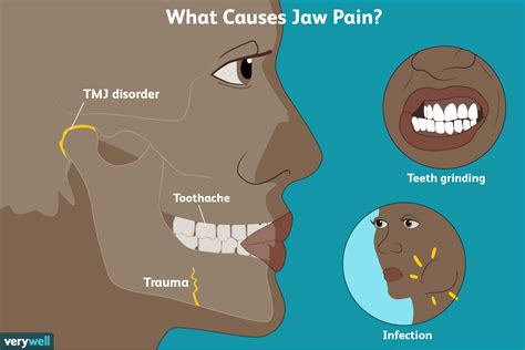 Jaw Pain Symptoms Causes Diagnosis And Treatment