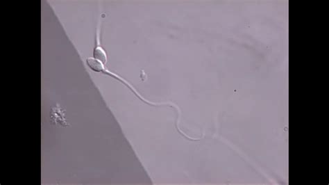 Sperm Swimming In Microscope Field Youtube