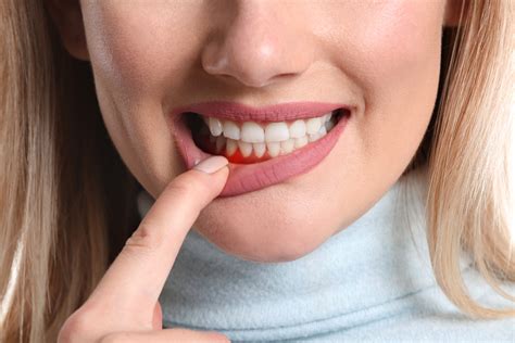 Black Gums How You Can Improve Your Oral Hygiene Healthwire