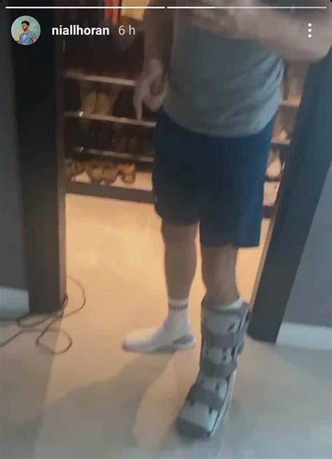 Fans Worried As Niall Horan Shows Off Unexplained Leg Injury