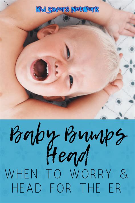 Baby Bumps Head When To Worry And Head For The Er Infographic In