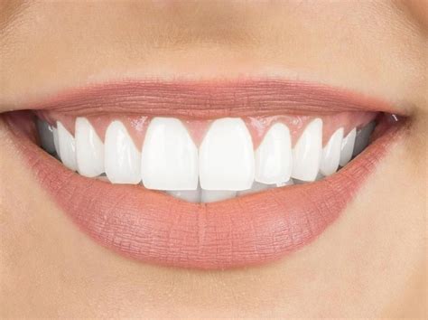 Cara untuk menjadikan gigi putih dengan cuka sari apel sangat sederhana. Bleaching Gigi Jogja: Tips Mudah Menggunakan Garam Untuk ...