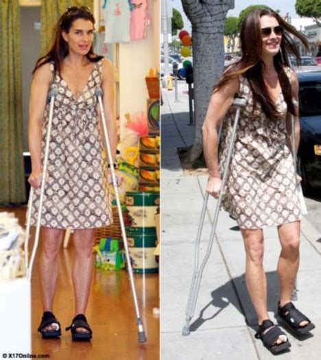 Crock Shields Brooke Hobbles Around La After Foot Surgery Daily Mail