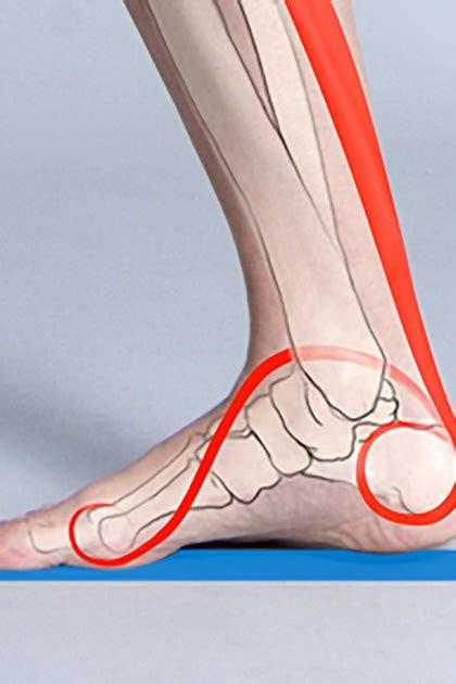 Die achillessehnenentzündung oder achillotendinitis ist die entzündung der großen sehne im hinteren knöchelbereich in folge eines traumas oder einer überlastung. Achillessehnenentzündung: Läuferkrankheit Nummer 1 - Datasport