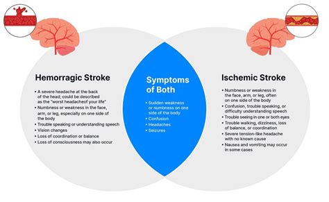 Ischemic Vs Hemorrhagic Strokes Types And Symptoms