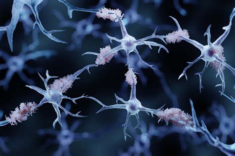 Protein Medin Wirkt Sich Auf Alzheimer Erkrankung Aus Mta Das Portal